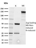 CD5 Antibody in SDS-PAGE (SDS-PAGE)