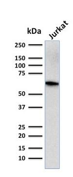 CD5 Antibody in Western Blot (WB)