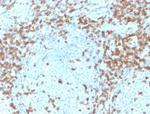 CD5 (Mantle Cell Lymphoma Marker) Antibody in Immunohistochemistry (Paraffin) (IHC (P))