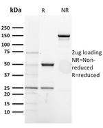 CD5 (Mantle Cell Lymphoma Marker) Antibody in SDS-PAGE (SDS-PAGE)