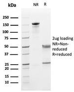 CD5 (Mantle Cell Lymphoma Marker) Antibody in SDS-PAGE (SDS-PAGE)