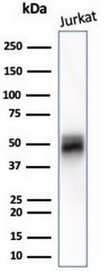 CD5 (Mantle Cell Lymphoma Marker) Antibody in Western Blot (WB)