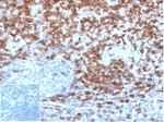 CD5 (Mantle Cell Lymphoma Marker) Antibody in Immunohistochemistry (Paraffin) (IHC (P))