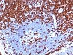 CD5 (Mantle Cell Lymphoma Marker) Antibody in Immunohistochemistry (Paraffin) (IHC (P))