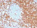 CD5 Antibody in Immunohistochemistry (Paraffin) (IHC (P))