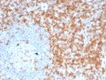 CD5 Antibody in Immunohistochemistry (Paraffin) (IHC (P))