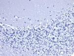 CD5 Antibody in Immunohistochemistry (Paraffin) (IHC (P))