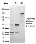 CD5 Antibody in SDS-PAGE (SDS-PAGE)