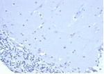 CD5 (Mantle Cell Lymphoma Marker) Recombinant Rabbit Monoclonal Antibody (C5/6438R)