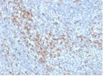 CD5 (Mantle Cell Lymphoma Marker) Antibody in Immunohistochemistry (Paraffin) (IHC (P))