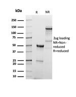 CD5 (Mantle Cell Lymphoma Marker) Antibody in SDS-PAGE (SDS-PAGE)