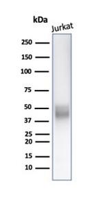 CD5 (Mantle Cell Lymphoma Marker) Antibody in Western Blot (WB)