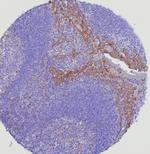 CD5 (Mantle Cell Lymphoma Marker) Antibody in Immunohistochemistry (Paraffin) (IHC (P))