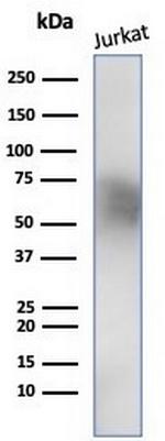 CD5 (Mantle Cell Lymphoma Marker) Antibody in Western Blot (WB)