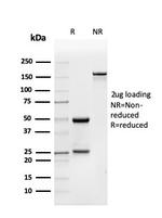BMP15/GDF9B Monoclonal Antibody (BMP15/4263)