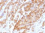 Aurora B (Proliferation Marker) Monoclonal Antibody (AURKB/1592)