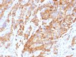 Aurora B (Proliferation Marker) Antibody in Immunohistochemistry (Paraffin) (IHC (P))