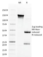 Aurora B (Proliferation Marker) Antibody in SDS-PAGE (SDS-PAGE)