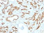 Aurora B Monoclonal Antibody (AURKB, 1593)