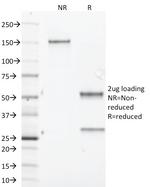 Aurora B (Proliferation Marker) Antibody in SDS-PAGE (SDS-PAGE)