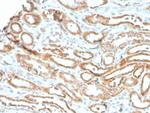 Aurora B (Proliferation Marker) Antibody in Immunohistochemistry (Paraffin) (IHC (P))