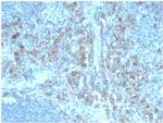 CD5 Antibody in Immunohistochemistry (Paraffin) (IHC (P))