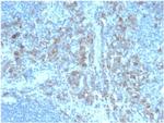CD5L/CD5LG/CD5 Ligand Monoclonal Antibody (CD5L/4420)