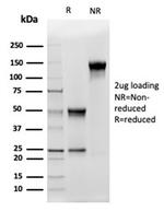 CD5L/CD5LG/CD5 Ligand Antibody in SDS-PAGE (SDS-PAGE)