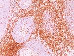CD6 (Negative Marker of T-regulatory Cells) Antibody in Immunohistochemistry (Paraffin) (IHC (P))