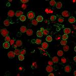 CD6 (Negative Marker of T-regulatory Cells) Antibody in Immunocytochemistry (ICC/IF)