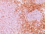 CD6 (Negative Marker of T-regulatory Cells) Antibody in Immunohistochemistry (Paraffin) (IHC (P))