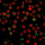 CD6 (Negative Marker of T-regulatory Cells) Monoclonal Antibody (SPV-L14)