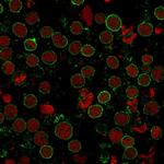CD6 (Negative Marker of T-regulatory Cells) Antibody in Immunocytochemistry (ICC/IF)