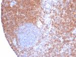 CD6 Antibody in Immunohistochemistry (Paraffin) (IHC (P))