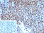 CD6 Antibody in Immunohistochemistry (Paraffin) (IHC (P))