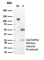 CD6 (Negative Marker of T-regulatory Cells) Antibody in Immunoelectrophoresis (IE)