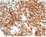 CD6 (Negative Marker of T-regulatory Cells) Antibody in Immunohistochemistry (Paraffin) (IHC (P))