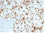 CD6 (Negative Marker of T-regulatory Cells) Antibody in Immunohistochemistry (Paraffin) (IHC (P))