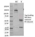 CD7 (T-Cell Leukemia Marker) Antibody in SDS-PAGE (SDS-PAGE)
