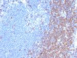 CD7 (T-Cell Leukemia Marker) Antibody in Immunohistochemistry (Paraffin) (IHC (P))