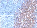 CD7 (T-Cell Leukemia Marker) Antibody in Immunohistochemistry (Paraffin) (IHC (P))