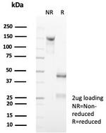 CD7 (T-Cell Leukemia Marker) Antibody in SDS-PAGE (SDS-PAGE)
