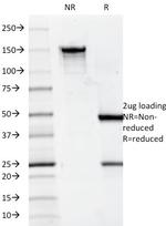 CD7 (T-Cell Leukemia Marker) Antibody in SDS-PAGE (SDS-PAGE)