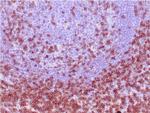 CD7 (T-Cell Leukemia Marker) Antibody in Immunohistochemistry (Paraffin) (IHC (P))