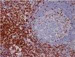 CD7 (T-Cell Leukemia Marker) Antibody in Immunohistochemistry (Paraffin) (IHC (P))