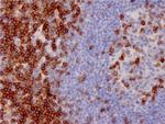 CD7 (T-Cell Leukemia Marker) Antibody in Immunohistochemistry (Paraffin) (IHC (P))
