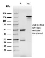CD7 (T-Cell Leukemia Marker) Antibody in SDS-PAGE (SDS-PAGE)