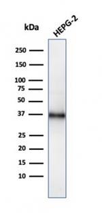 CD7 (T-Cell Leukemia Marker) Antibody in Western Blot (WB)