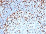 CD7 Antibody in Immunohistochemistry (Paraffin) (IHC (P))