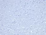 CD7 Antibody in Immunohistochemistry (Paraffin) (IHC (P))